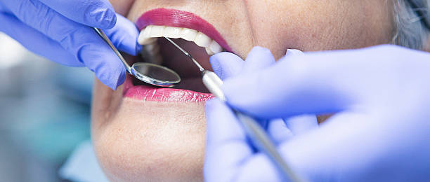 Best Emergency Dental Care for Broken or Chipped Teeth in Ben Lomond, CA
